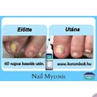 Imperial Feet, körömgomba 75ml , GYÁRTÁSI PROBLÉMÁK MIATT- HELYETTE AZ ANTIMIX TINKTÚRÁT JAVASOLJUK.